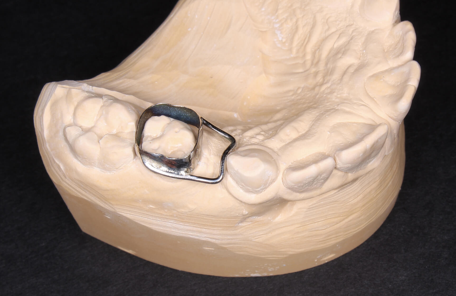 держатель места зуба на челюсти